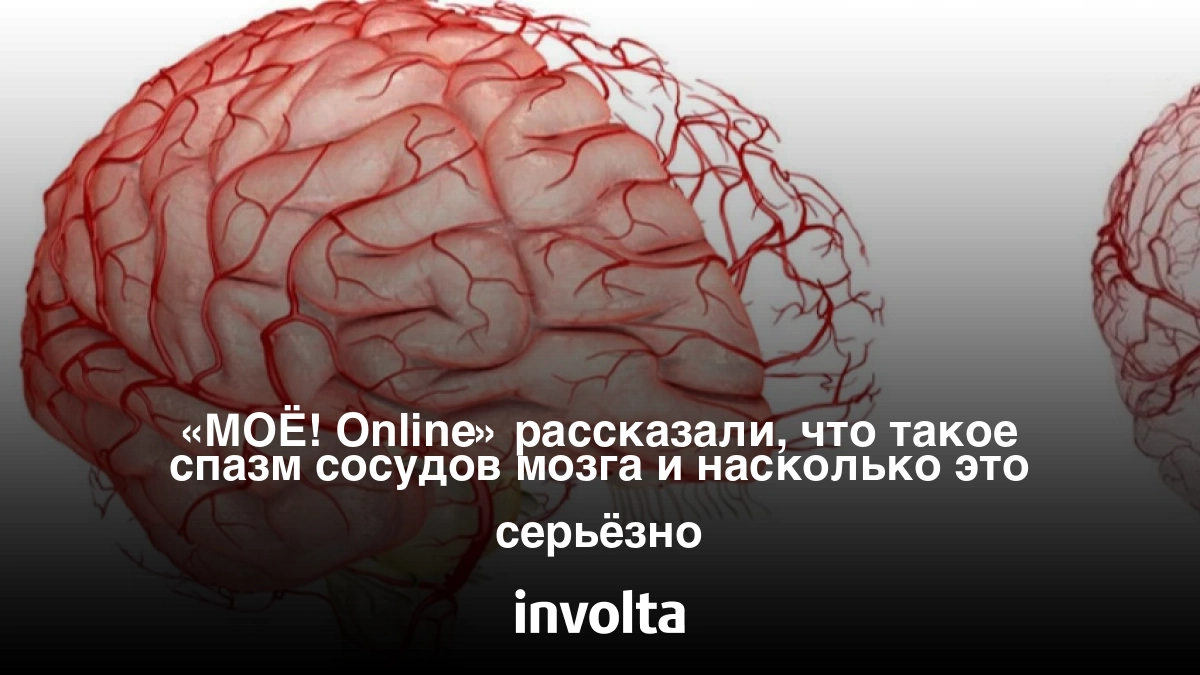 МОЁ! Online» рассказали, что такое спазм сосудов мозга и насколько это  серьёзно - INVOLTA TECHNOLOGIES