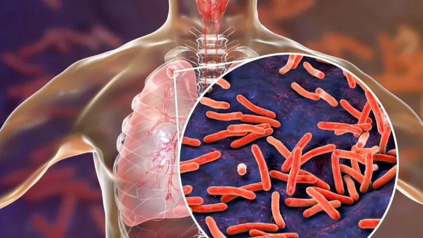 Ученые из России нашли перспективный антибиотик от туберкулеза и стафилококка