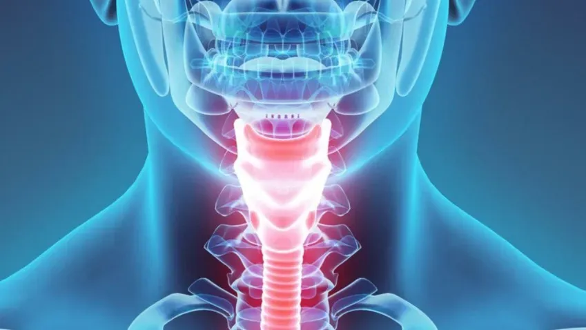 Lenta.ru: Житель США заболел раком горла, предположительно, из-за заболевания, которое...