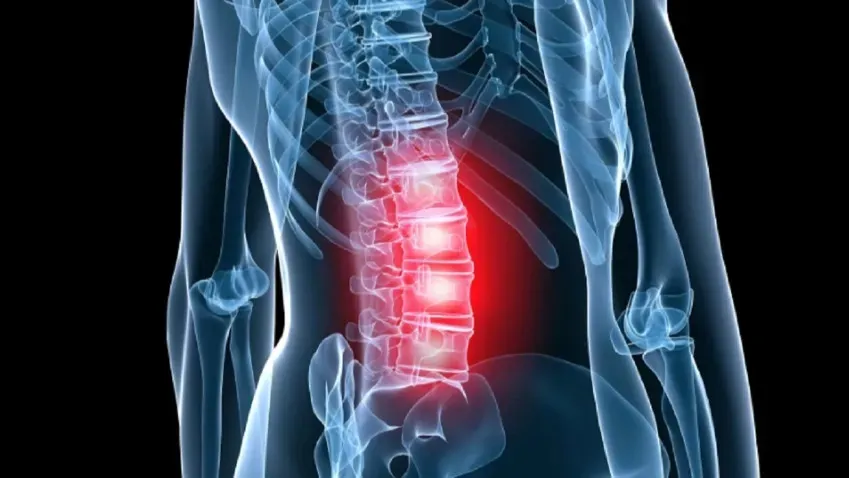 «АиФ» перечислил причины возникновения остеохондроза и основные способы его лечения
