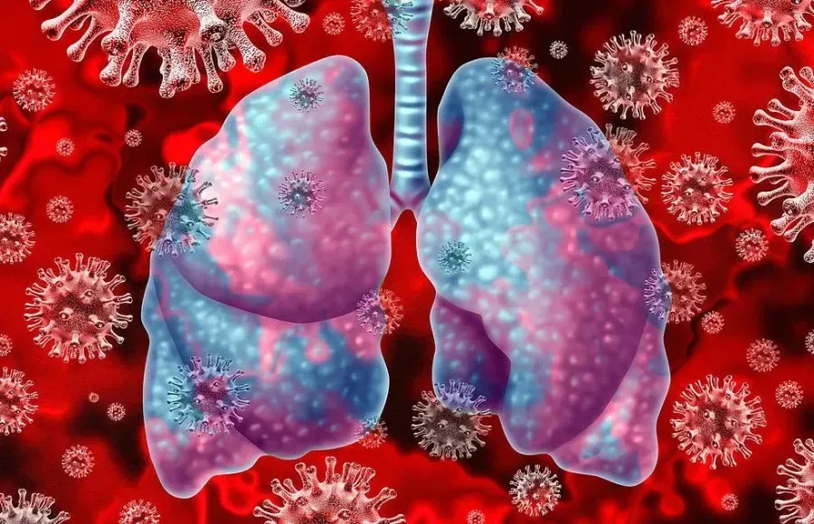 Источник: trmzk.ru