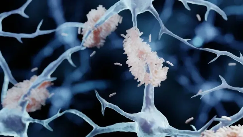 Нейробиологи нашли в крови биомаркер, который поможет легко определить болезнь Альцгеймера