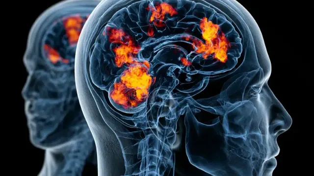 фМРТ помогает повысить эффективность лечения депрессии