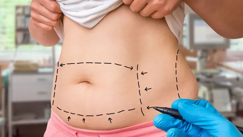 Obesity: операции по снижению веса имеют долгосрочные преимущества в профилактике рака