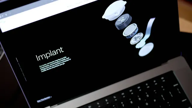 Новый мозговой имплантат Neuralink помогает обезьянам «видеть» через стимуляцию мозга