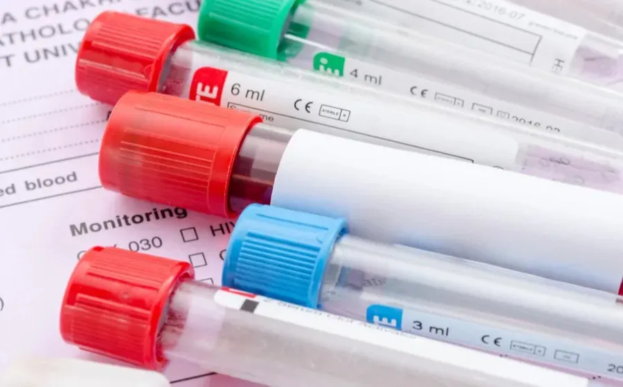 Новый метод анализа крови диагностирует риск диабета 2 типа у людей с нормальным весом