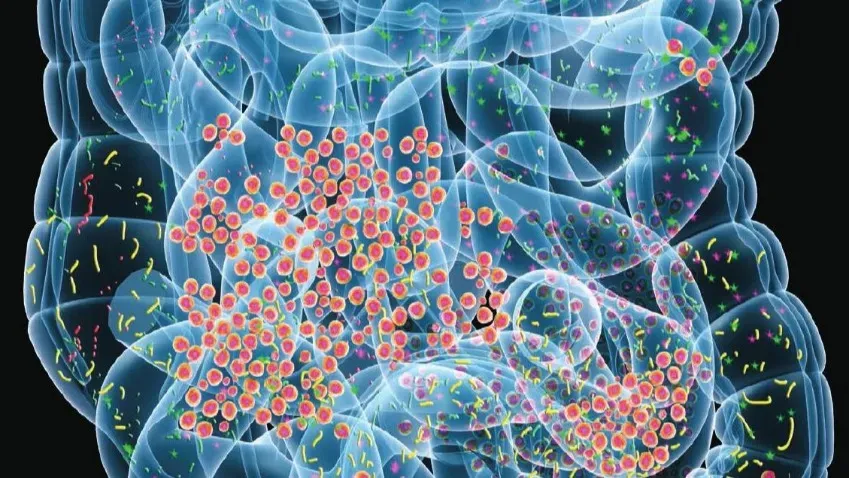 Science: повреждение головного мозга при болезни Альцгеймера усугубляют кишечные бактерии