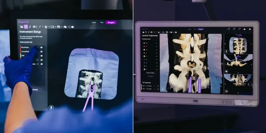 Источник: www.propriovision.com