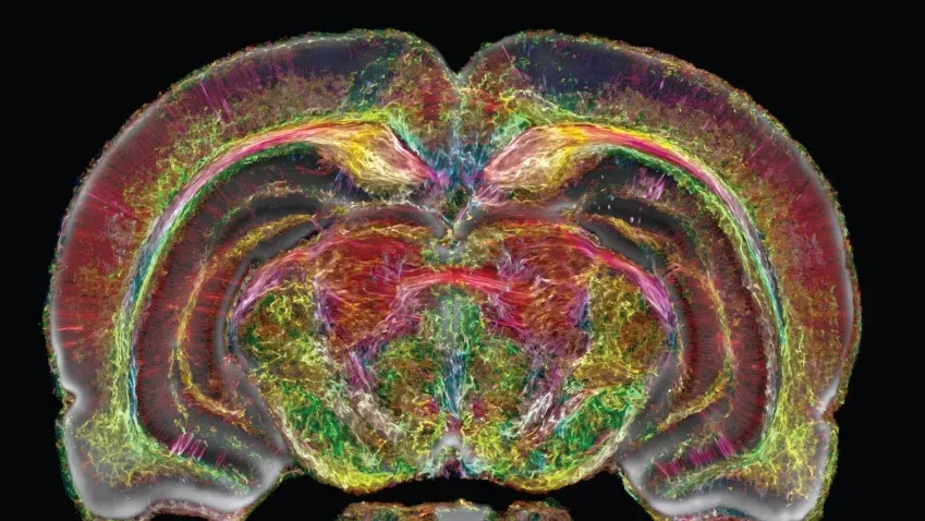 PNAS: в США учёными получены самые подробные МРТ-снимки мозга за всю историю