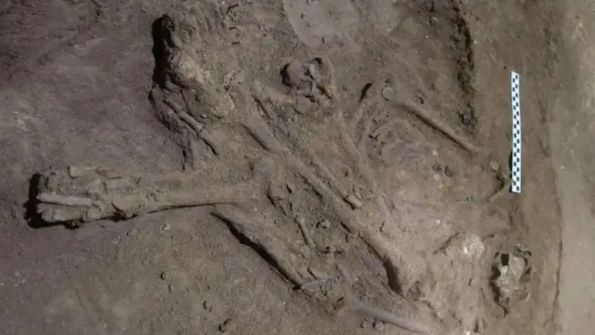 Anadolu Ajansı: первая ампутация могла быть проведена человеку 31 тысячу лет назад