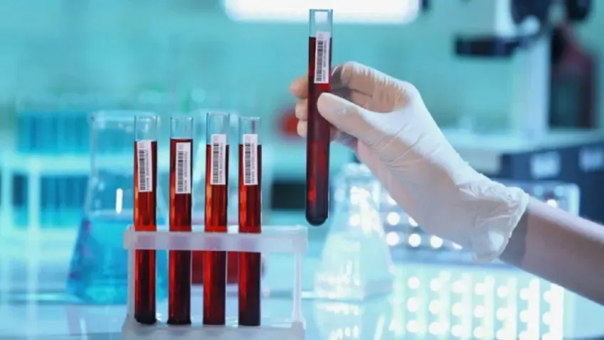 Ученые провели анализ и назвали группу крови, которая делает человека богатым