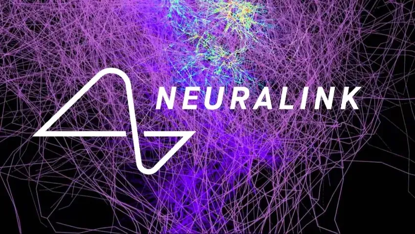 Все, что нужно знать о мозговом нейрочипе Neuralink