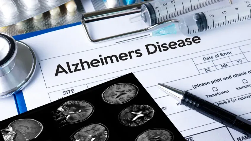 Ученые впервые в мире «заразили» животных болезнью Альцгеймера