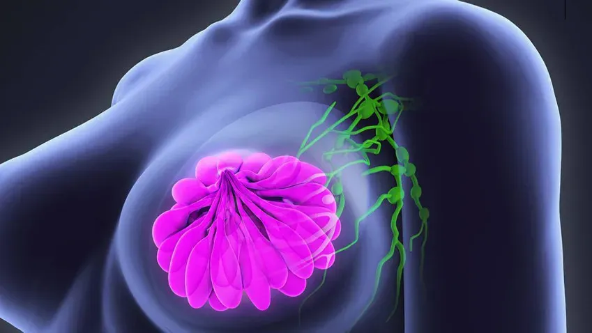 Онколог-маммолог: рак груди не может быть связан с приемом контрацептивов