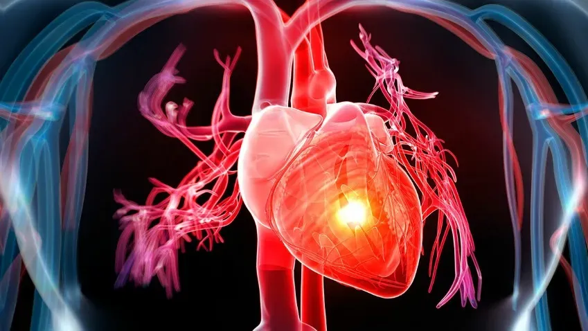 Новый алгоритм ИИ исключает сердечные приступы с точностью до 99%