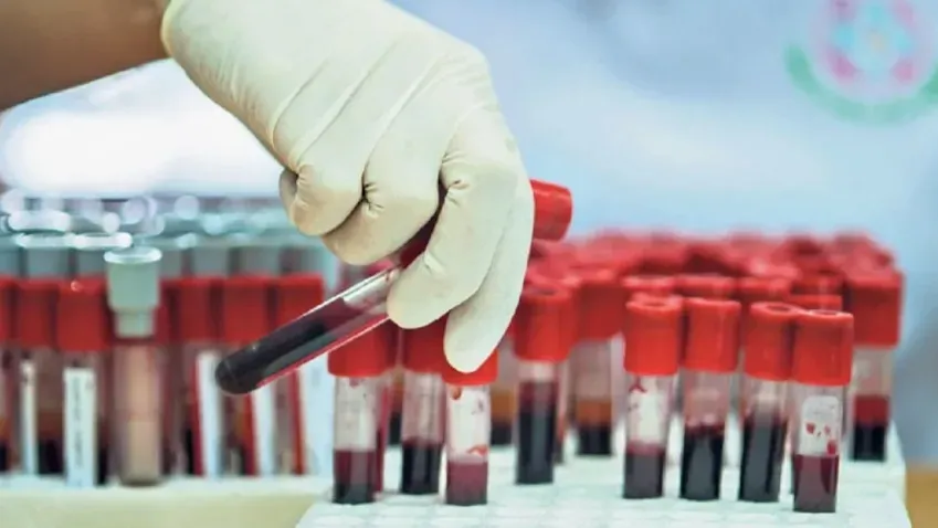 Ученые запустили итоги исследования биомаркеров крови, влияющих на долголетие