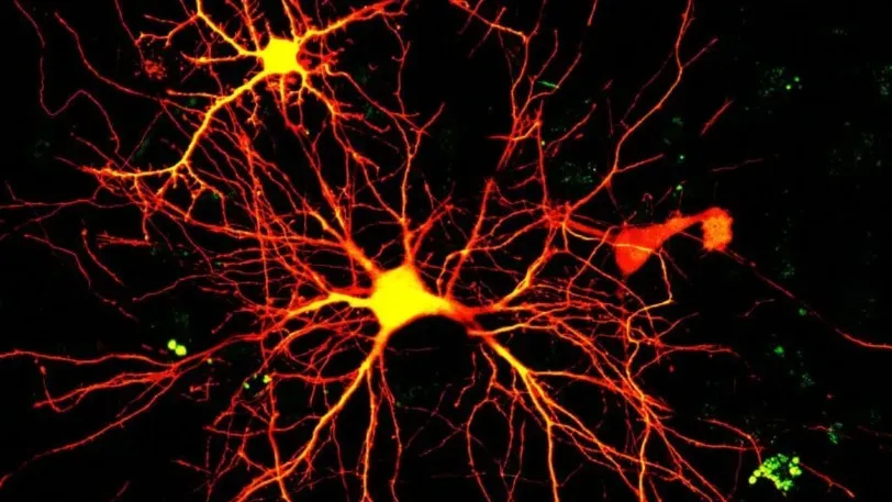 Ученые нашли новую причину гибели нейронов в мозге при болезни Альцгеймера