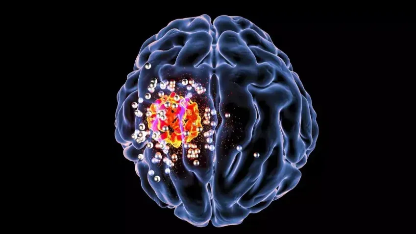 Cancer Cell: воздействие на метаболический процесс в раковых клетках может служить эффективным...