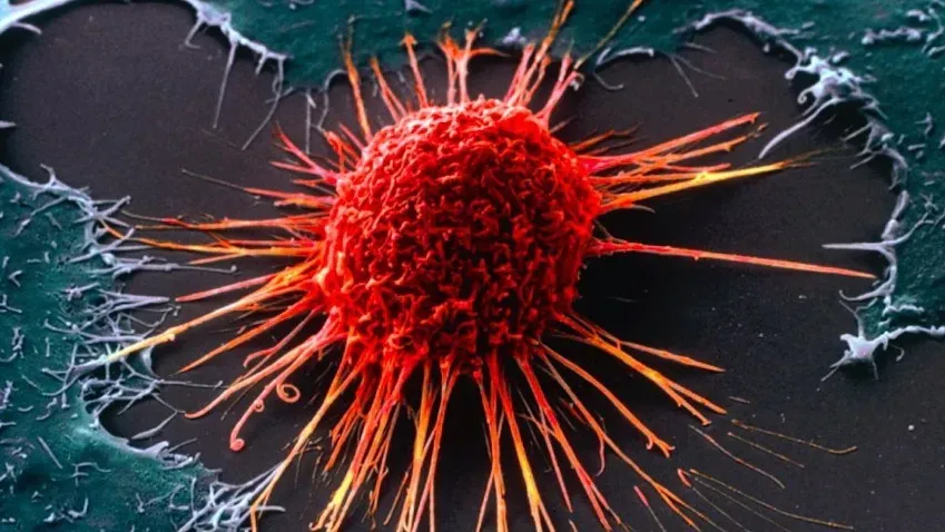 Ученые запустили выживаемость в 4 раза выше для особо агрессивной формы рака