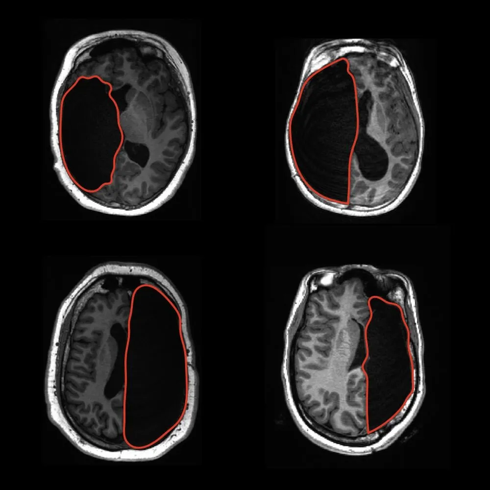 Фото: MedicalXpress