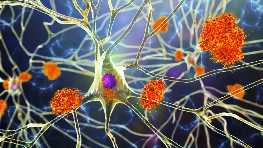 Scientific Reports: уточнена роль гормона соматостатина в развитии болезни Альцгеймера
