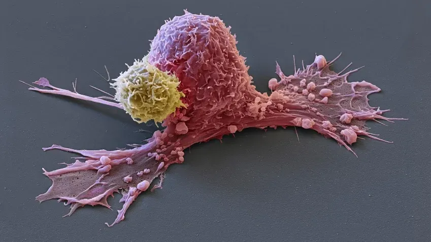 Science Advances: выявленные новые детали клеточного процесса предотвратят развитие рака