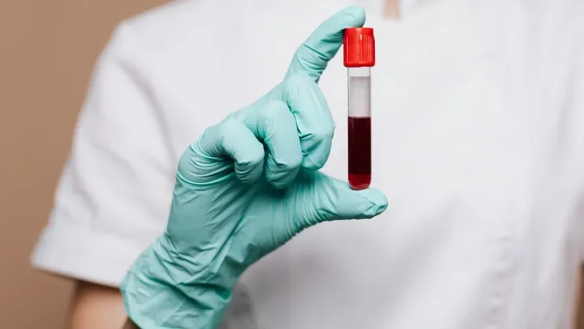 Ученые FDA выявили, что новая генная терапия серповидноклеточной анемии безопасна
