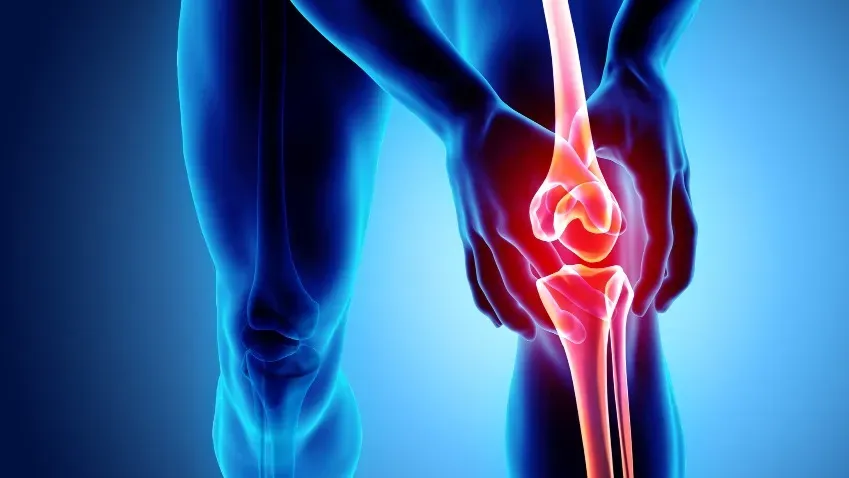 Врачи сообщили, какая нагрузка полезна при остеоартрите коленного сустава