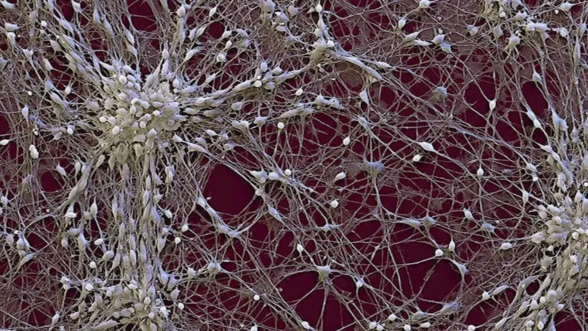 Ткань мозга с живыми нейронами впервые напечатали на 3D-принтере