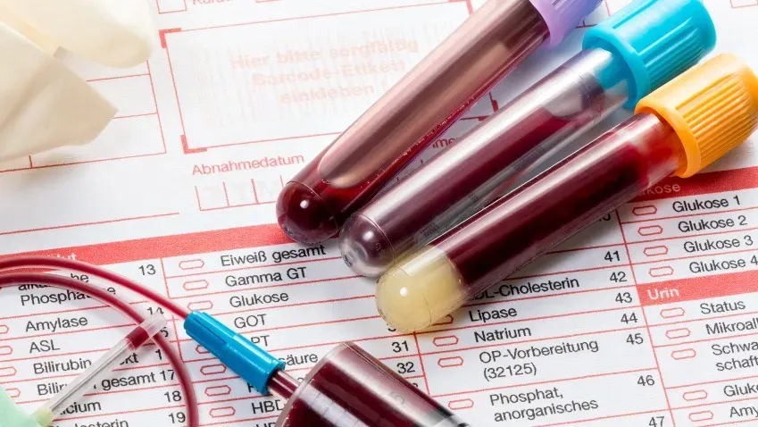 Компания Freenome начала клинические испытания анализа крови на рак легких