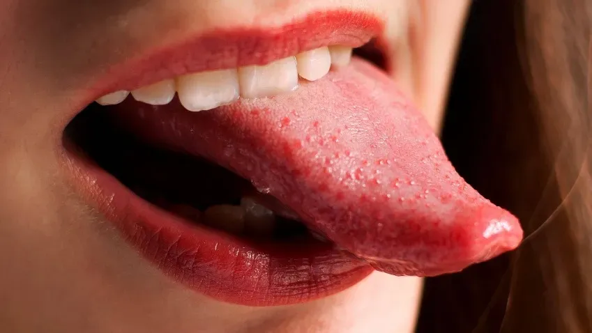 Ученые выяснили, как плотность нервов в раковой опухоли полости рта связана с ее ростом