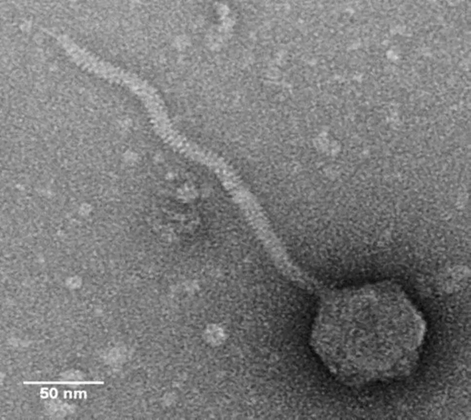Новый вид вируса под микроскопом. Фото: La Trobe Univesity