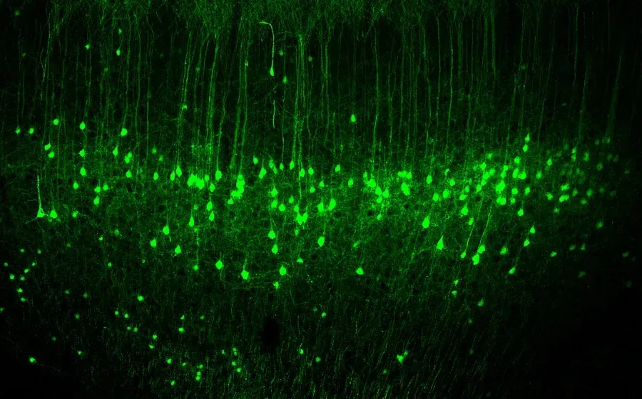 Nature: новые данные о нейронной активности мозга приблизили создание нейропротезов