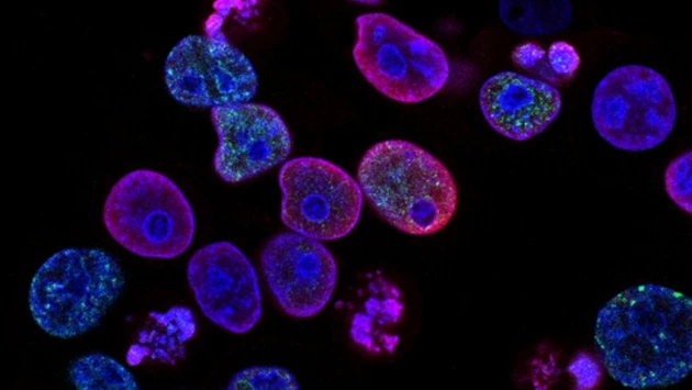 MedicalXpress: Американские ученые нашли новый способ для выявления подтипов рака печени