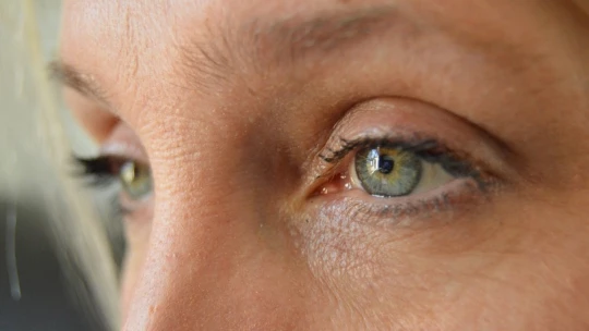 Planet Today: три цвета глаз названы факторами повышенного риска развития рака