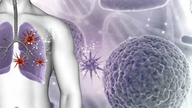 Cell: Ученые назвали факторы риска, связанные с эволюцией рака