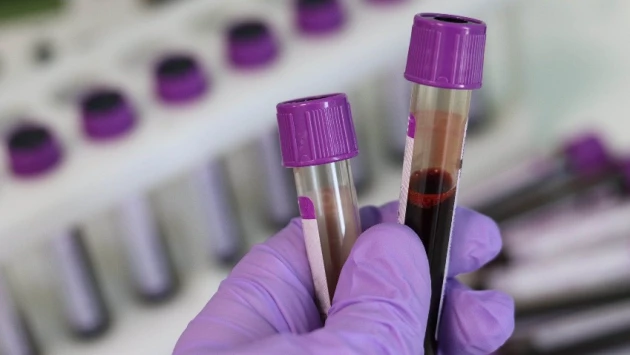 Ученые создали новый способ определения предрасположенности к шизофрении по анализу крови