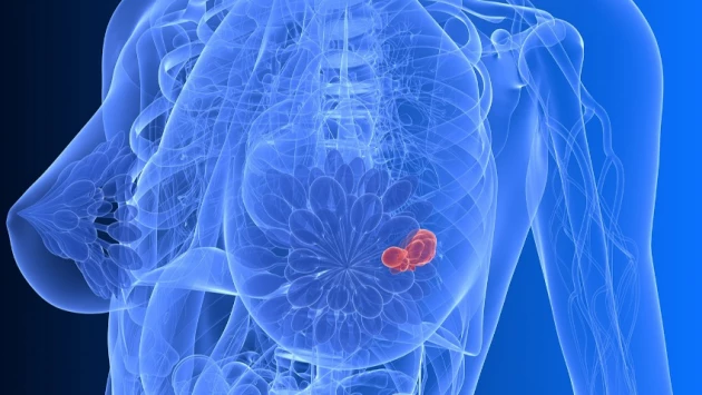 Cancer Research: Исследователи рака выявили новую цель для терапии рака молочной железы