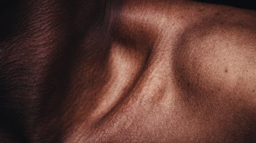 Судмедэксперт создала технологию обнаружения синяков на тёмной коже