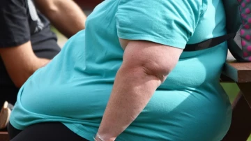 Врачи выяснили, что ушивание желудка при ожирении помогает и от недержания мочи