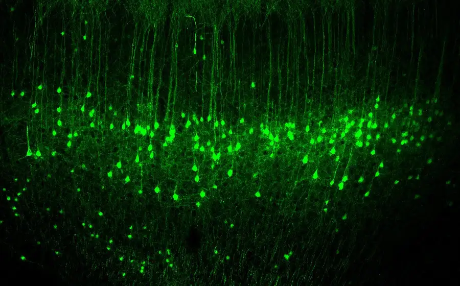 Nature: новые данные о нейронной активности мозга приблизили создание нейропротезов