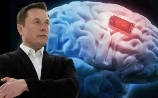 Рамблер: Илон Маск в следующем году планирует стать первым, кто имплантирует чип в мозг