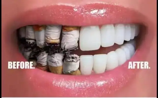 Врач-стоматолог Александр Гайдуков назвал три веские причины в пользу отказа от курения