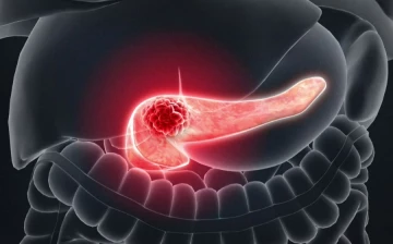 Исследование предлагает новый препарат против онкогена рака поджелудочной железы