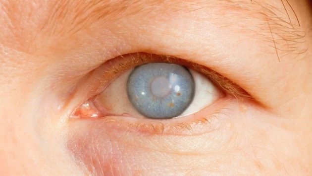 Molecular Therapy: японские учёные нашли способ борьбы с потерей зрения при глаукоме