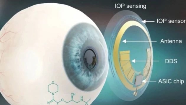 Учёные создали умные контактные линзы, способные контролировать протекание глаукомы