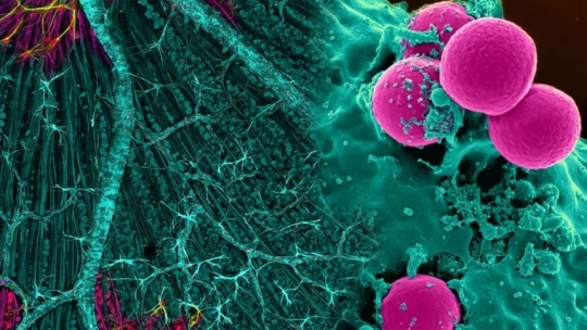 Science Advances: учёные выявили вещество, которым питаются раковые клетки