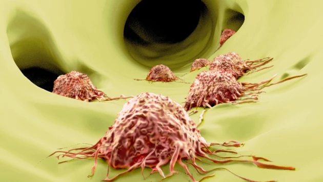 Учёные выяснили, как эффективно уничтожать рак при помощи "естественных клеток-киллеров"