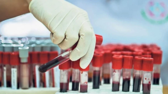 Ученые запустили теорию, какая группа крови реально помогает разбогатеть