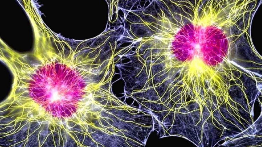 Nature Medicine: стволовые клетки успешно использовали против рассеянного склероза